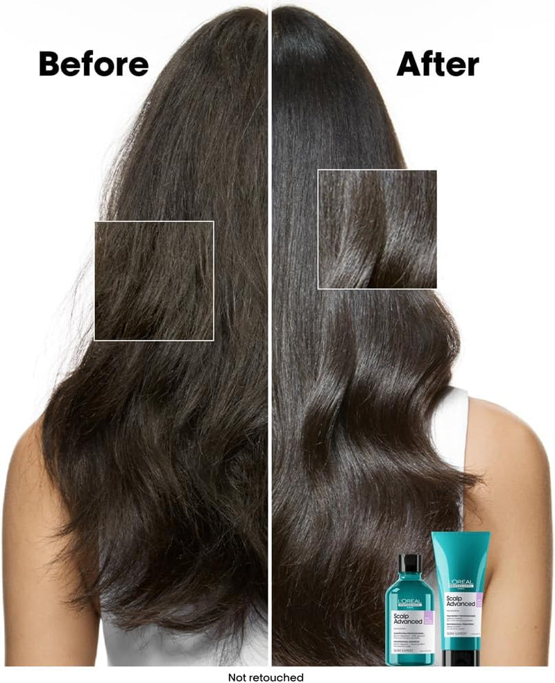 L’Oréal Professionnel Scalp Advanced Anti-Discomfort Shampoo, For Itchy and Dry Scalps, Deep Scalp Treatment L&