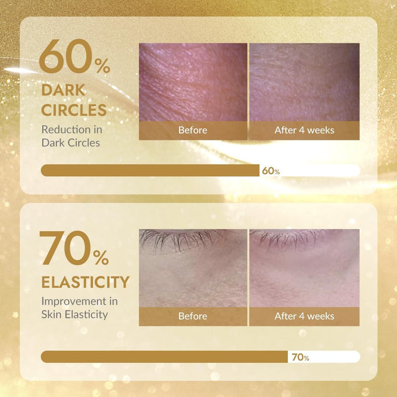 [MIZON] SNAIL REPAIR GOLD EYE GEL PATCH (x60) Korean skincare – Gold Eye Patches – Dark Circle & Anti-Aging Care – Snail Mucin Extract – Nourishes & Brightens the Eye Contour MIZON Store
