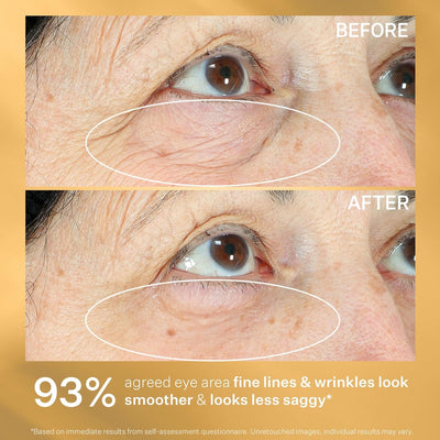 StriVectin Tighten & Lift Crepe Control Body Creams & Treatments, Improving Crepey & Saggy Skin, Hydrating Moisture for your Skin Greenwize